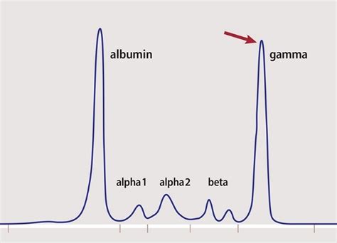 what is spep used for